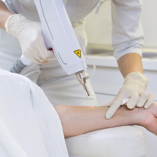 Huidschade na verwijderen tattoos: NVH pleit voor wettelijke borging van laserbehandelingen - Nederlandse Vereniging van Huidtherapeuten