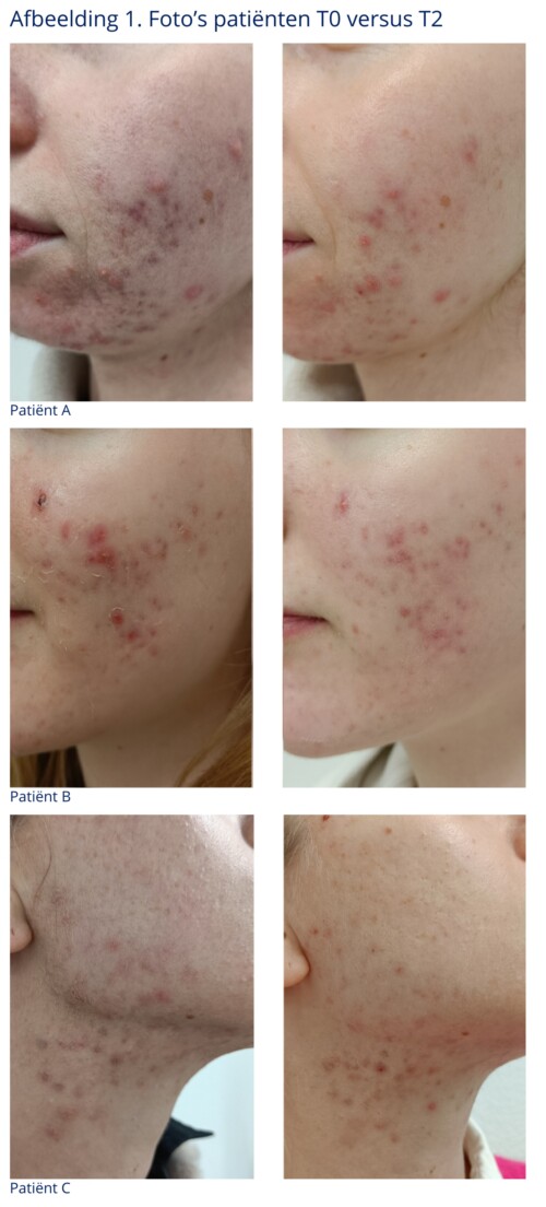 Nederlandse Vereniging van Huidtherapeuten