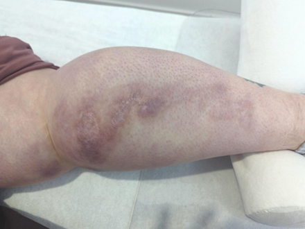 Nederlandse Vereniging van Huidtherapeuten