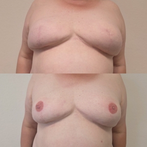 Nederlandse Vereniging van Huidtherapeuten