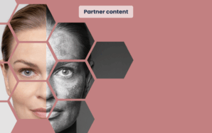 Consensus on hyperpigmentation - Nederlandse Vereniging van Huidtherapeuten