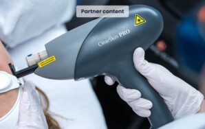 Licht en laser bij behandeling van acne en acne littekens - Nederlandse Vereniging van Huidtherapeuten