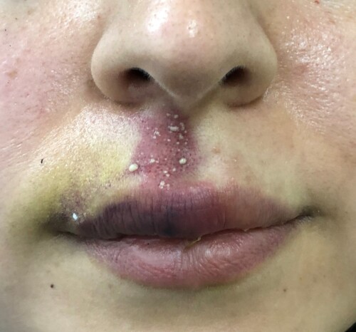 Nederlandse Vereniging van Huidtherapeuten