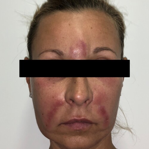 Nederlandse Vereniging van Huidtherapeuten