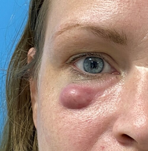 Nederlandse Vereniging van Huidtherapeuten