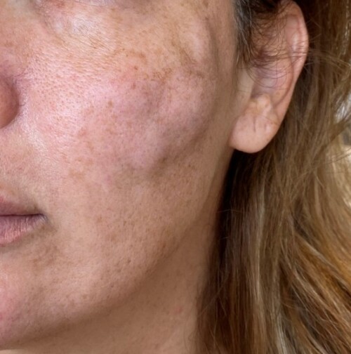 Nederlandse Vereniging van Huidtherapeuten